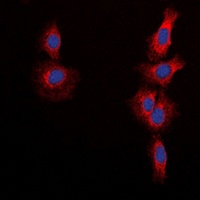 mTOR (Phospho-S2448) Rabbit Polyclonal Antibody