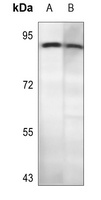 CD56 Rabbit Polyclonal Antibody
