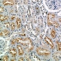 CD56 Rabbit Polyclonal Antibody