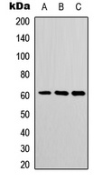 POTEH Rabbit Polyclonal Antibody