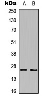 TNF alpha Rabbit Polyclonal Antibody