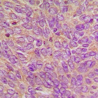 GCP6 Rabbit Polyclonal Antibody