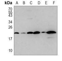 CXCL1 Rabbit Polyclonal Antibody