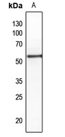 PTEN (Phospho-S380/T382/T383) Rabbit Polyclonal Antibody