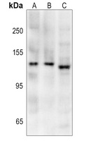 iNOS Rabbit Polyclonal Antibody