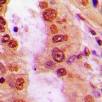 iNOS Rabbit Polyclonal Antibody