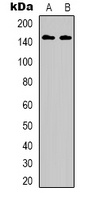 HER3 (Phospho-Y1222) Rabbit Polyclonal Antibody