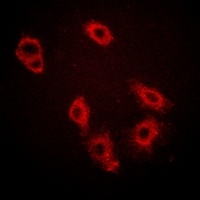 HER3 (Phospho-Y1222) Rabbit Polyclonal Antibody
