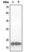 CBP20 Rabbit Polyclonal Antibody