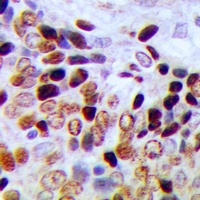 CBP20 Rabbit Polyclonal Antibody