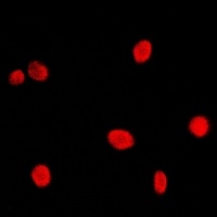 CBP20 Rabbit Polyclonal Antibody