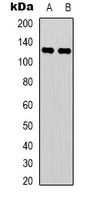 C/EBP zeta Rabbit Polyclonal Antibody