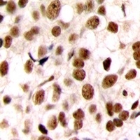 C/EBP zeta Rabbit Polyclonal Antibody