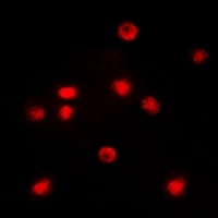 C/EBP zeta Rabbit Polyclonal Antibody