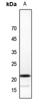 CBFB Rabbit Polyclonal Antibody