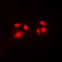 CBFB Rabbit Polyclonal Antibody