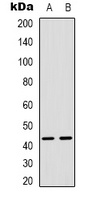 MAPKAPK3 Rabbit Polyclonal Antibody