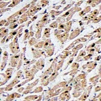 MAPKAPK3 Rabbit Polyclonal Antibody