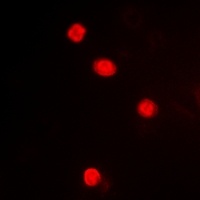 MAPKAPK3 Rabbit Polyclonal Antibody
