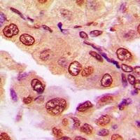DPF2 Rabbit Polyclonal Antibody