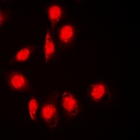 DPF2 Rabbit Polyclonal Antibody
