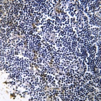 Collagen 19 alpha 1 Rabbit Polyclonal Antibody