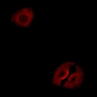Collagen 19 alpha 1 Rabbit Polyclonal Antibody