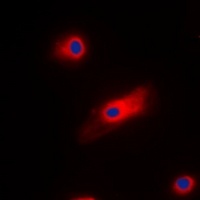 Cone Arrestin Rabbit Polyclonal Antibody