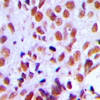 RAD21 Rabbit Polyclonal Antibody