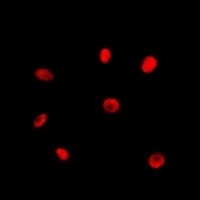 RAD21 Rabbit Polyclonal Antibody