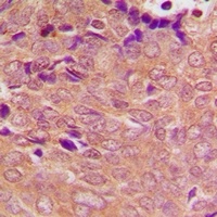 PSMC3 Rabbit Polyclonal Antibody