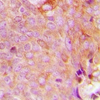 MRPS9 Rabbit Polyclonal Antibody