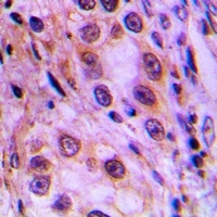 MRPL41 Rabbit Polyclonal Antibody