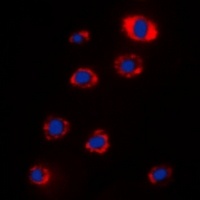 RPS12 Rabbit Polyclonal Antibody