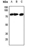 ACSS1 Rabbit Polyclonal Antibody