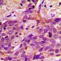 ACSS1 Rabbit Polyclonal Antibody