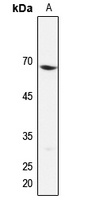 EIF3D Rabbit Polyclonal Antibody