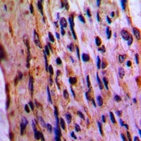 EIF3D Rabbit Polyclonal Antibody