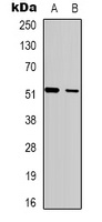 SH2D2A Rabbit Polyclonal Antibody