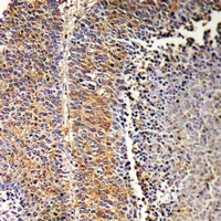 SH2D2A Rabbit Polyclonal Antibody