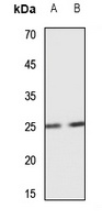 SCN4B Rabbit Polyclonal Antibody