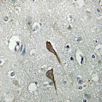 TMBIM4 Rabbit Polyclonal Antibody
