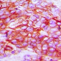 ZNT1 Rabbit Polyclonal Antibody