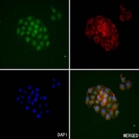 Kallikrein 3 Rabbit Polyclonal Antibody