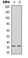NGF beta Rabbit Polyclonal Antibody