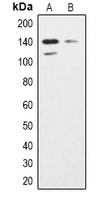 SHIP2 Rabbit Polyclonal Antibody