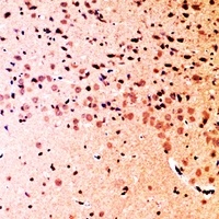 SHIP2 Rabbit Polyclonal Antibody
