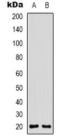 CD3d Rabbit Polyclonal Antibody