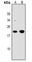 CD3e Rabbit Polyclonal Antibody
