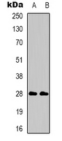 CD58 Rabbit Polyclonal Antibody